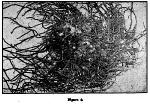 Fig. 55. Fig. 8. Irregular root mass.